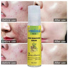 Temulawak - New Acne Removing Serum (Original) 4