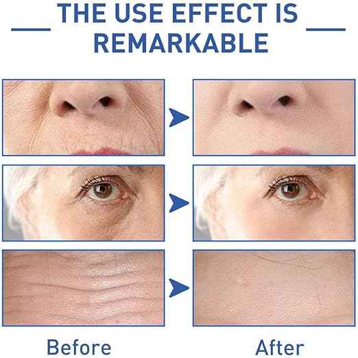 SADOER Retinol Caffeine Anti-Wrinkle Eye Cream – Dark Circle & Puffiness Reducer