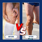 Synovial Pain Relief Ointment – Joint & Muscle Pain Cream 4