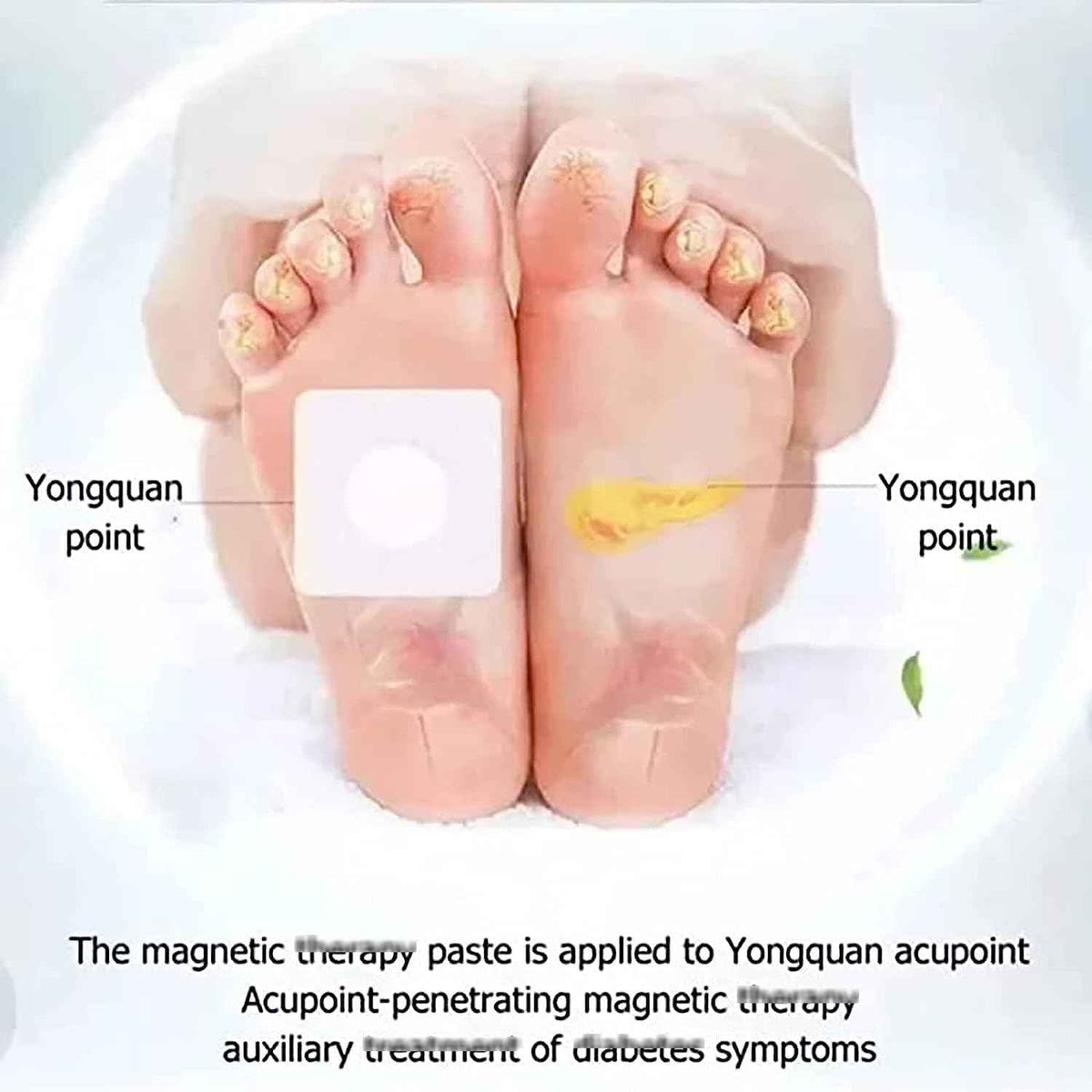 Huatangxiao Acupoint Pressure Stimulation Stickers