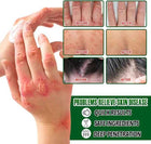 Psoriasis Cream - Herbal Plant Extracts 5