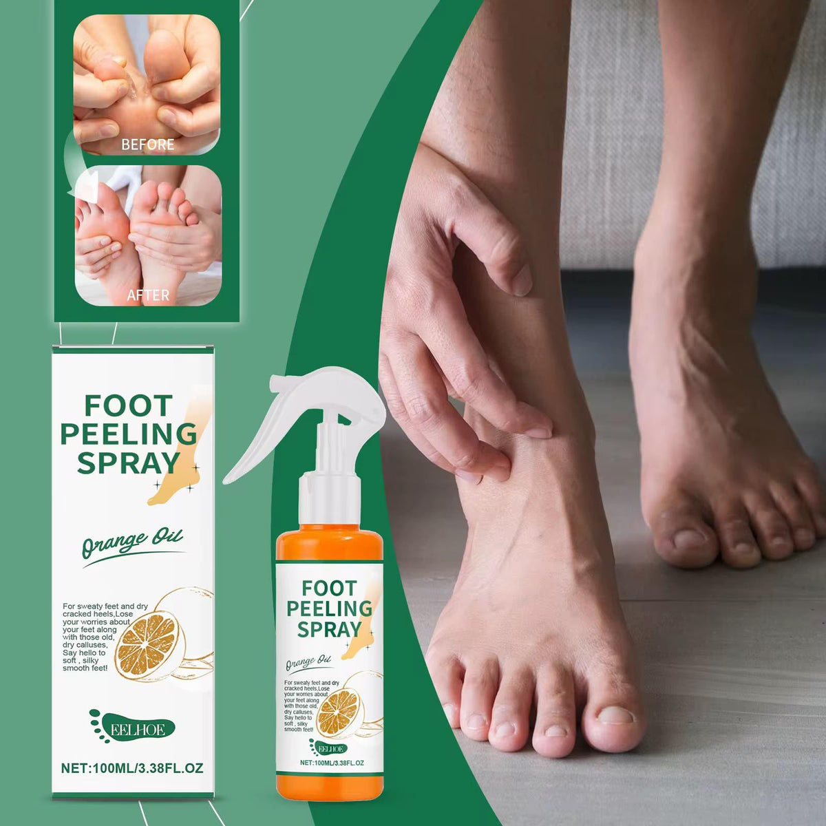 Foot Peeling Spray with Orange Oil | Deep Cleansing & Moisturising Heel Repair | بخاخ تقشير القدمين بزيت البرتقال