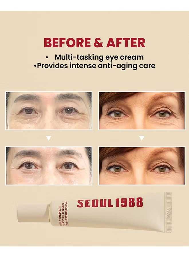 SEOUL 1988 Eye Cream – Anti-Aging Dark Circle & Wrinkle Treatment